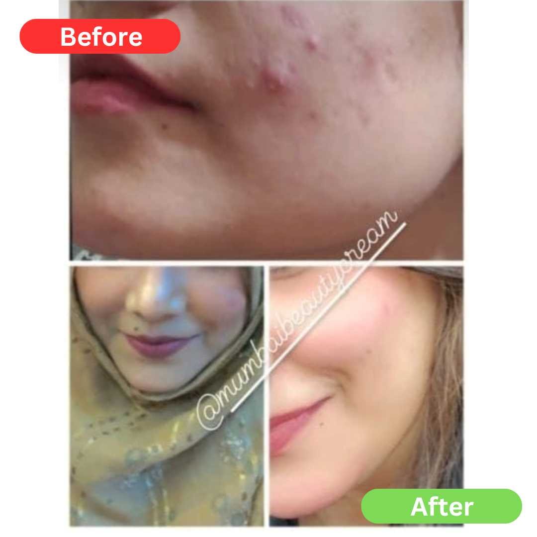 SPECIAL Pigmentation & Glow Combo | Night Cream + Vitamin C Serum