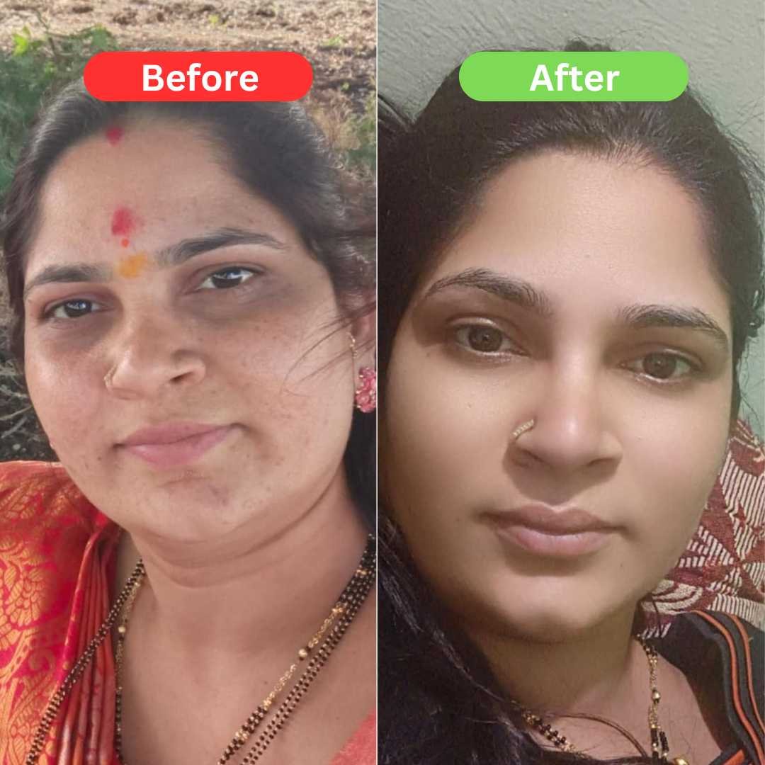 SPECIAL Pigmentation & Glow Combo | Night Cream + Vitamin C Serum