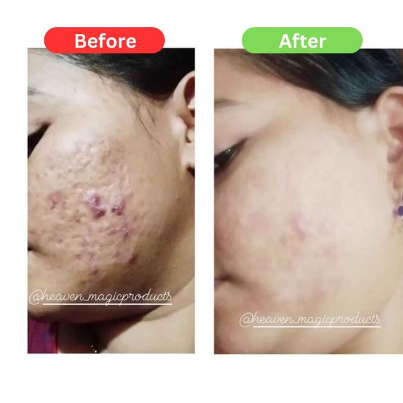 Heaven Magic Bridal Super Powerful Cream for Face (40gm)